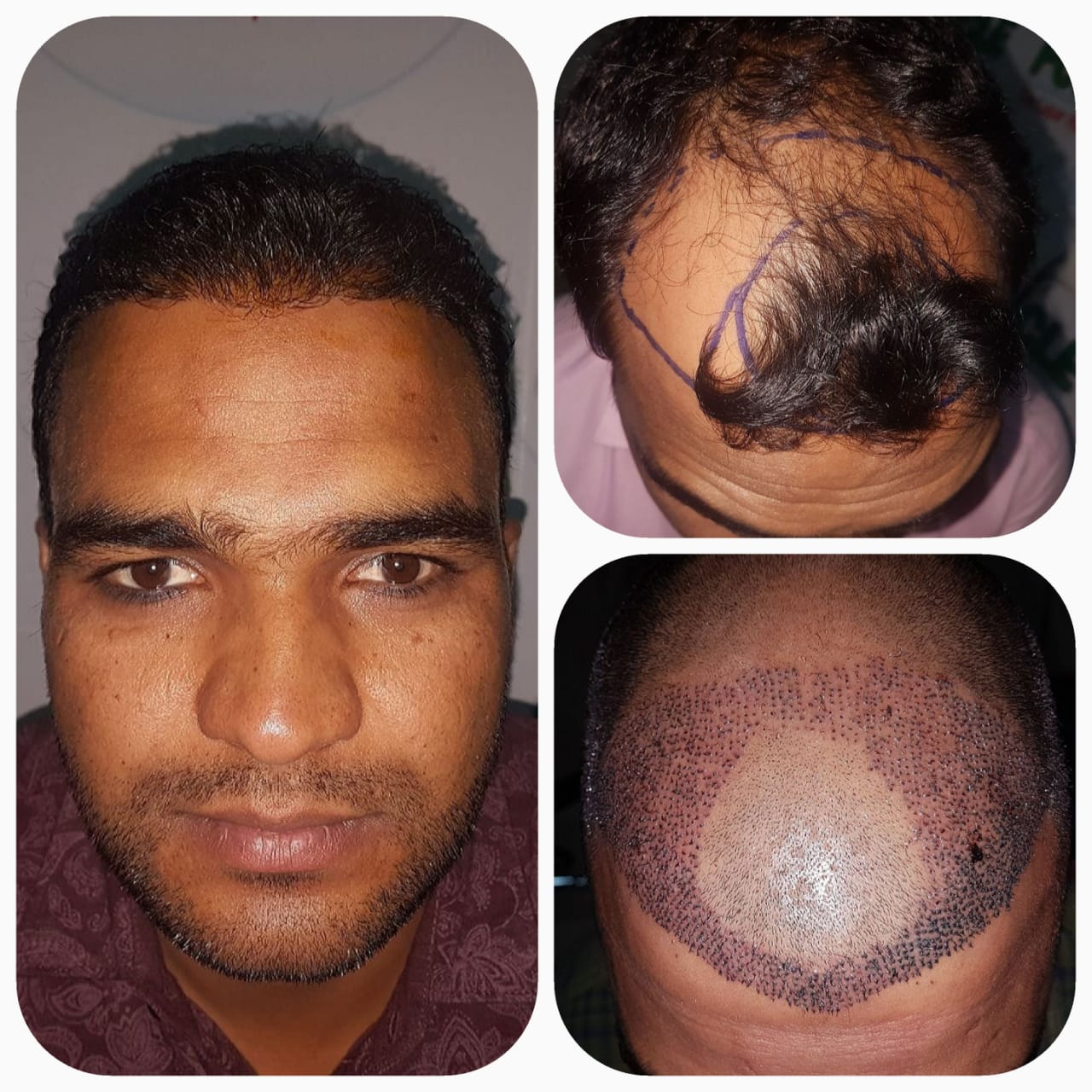 Hair Treatment Result