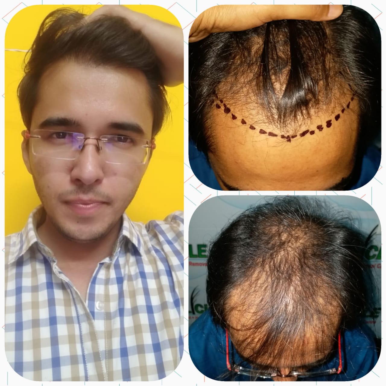 Hair Treatment Result