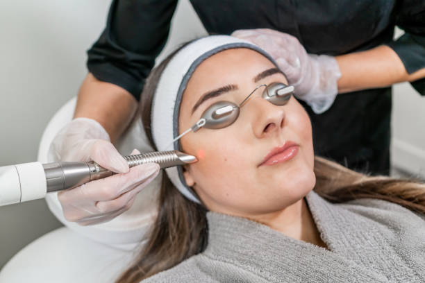 Complete Guide to Laser Hair Reduction in Pune